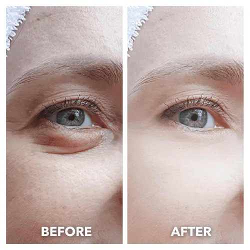 NUNEA LumiLift™ Red Light Eye Rejuvenator